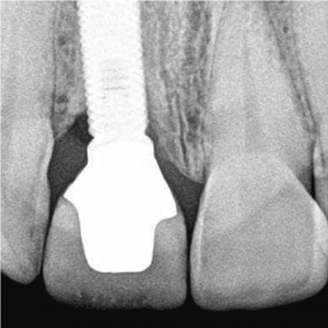 nuevo-dientes-5